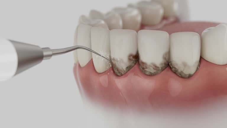 Trusted Dental Implants service in Middle River, MD - Dentist Open Now